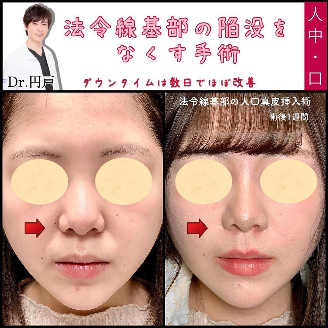 貴族手術の症例