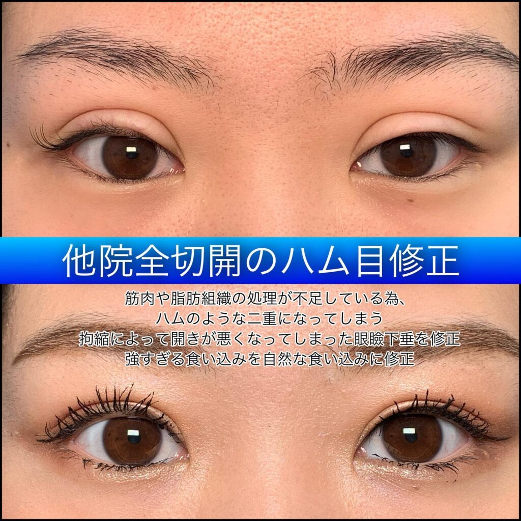 目元 