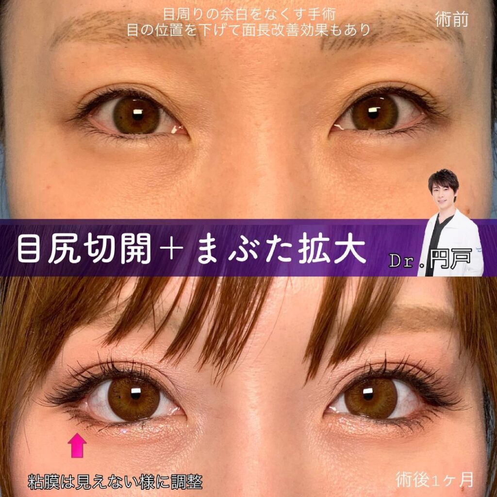 近づけないと傷は見えないです。 （Page 2/3 | 「近づけない」「叫べ 