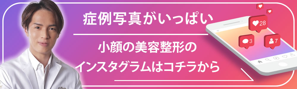 小顔のインスタバナー