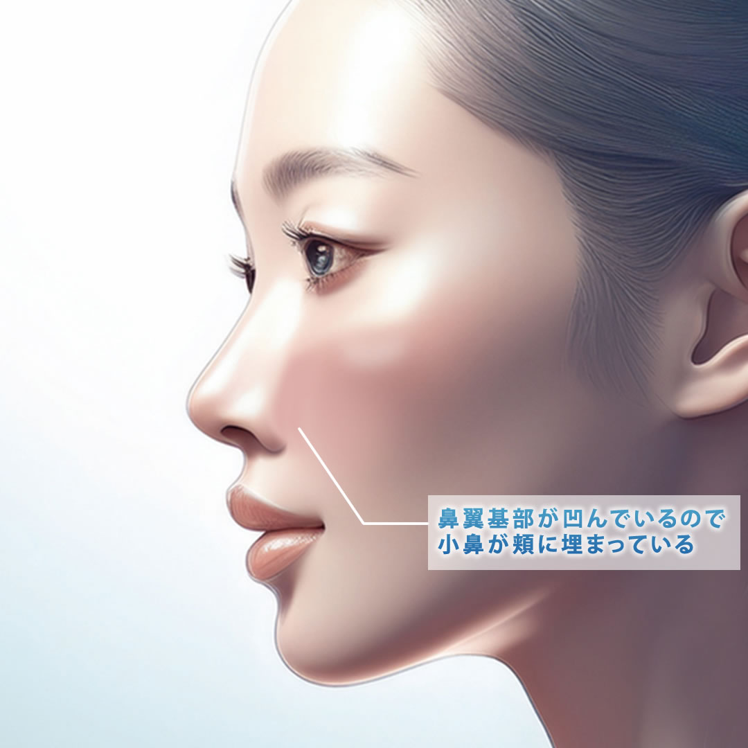 平たい顔を治す方法とは?「サル顔」「ゴリラ顔」の印象を治したい方必見!|金沢の美容外科はeクリニック