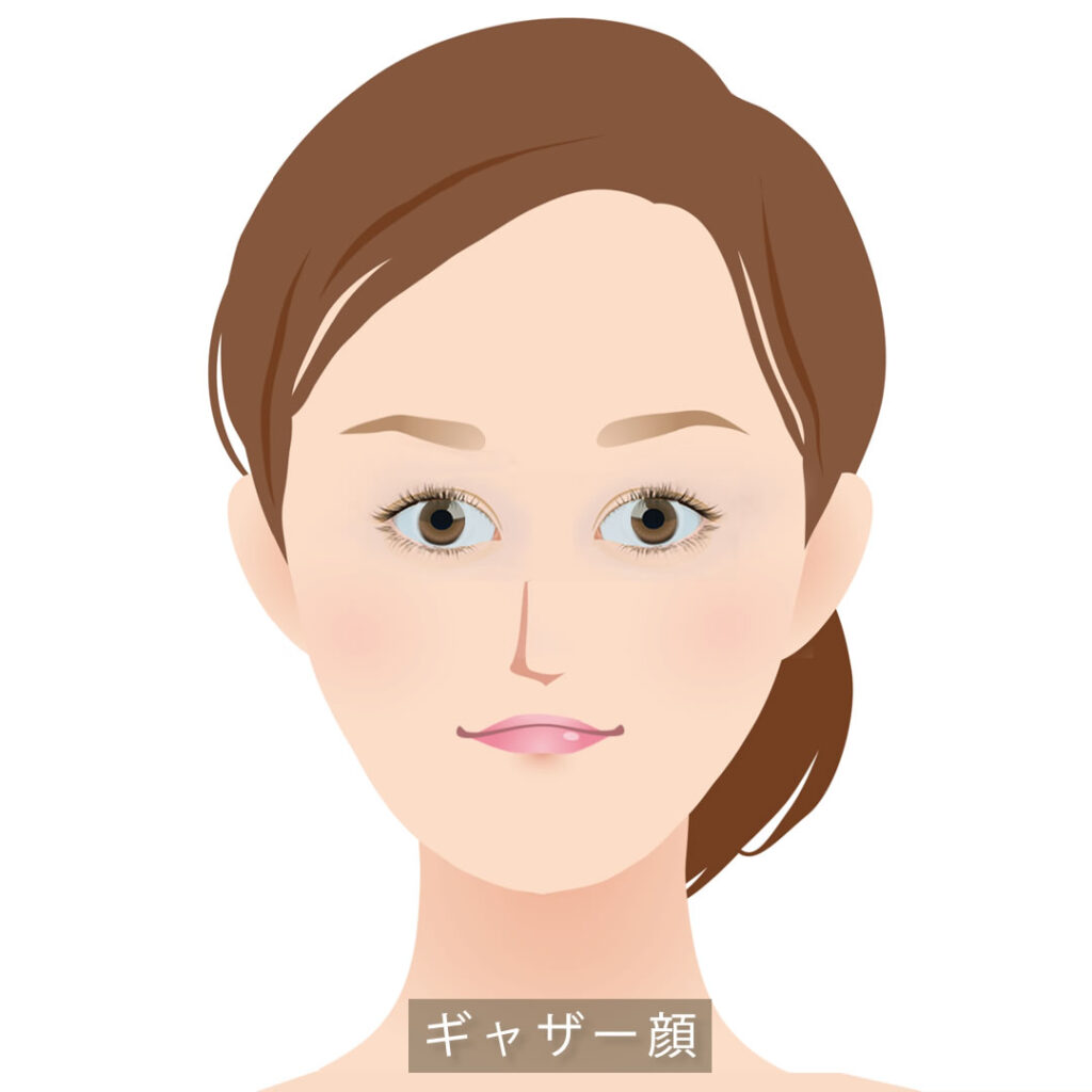 ギャザー顔のイメージ