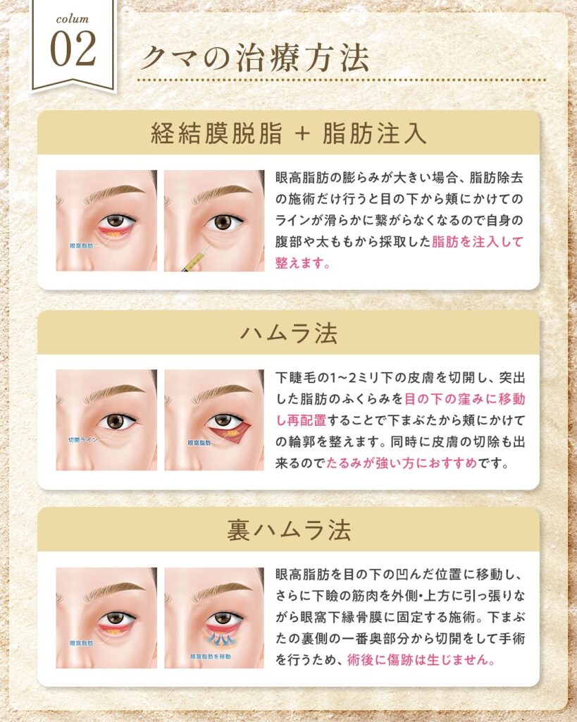 クマの施術方法