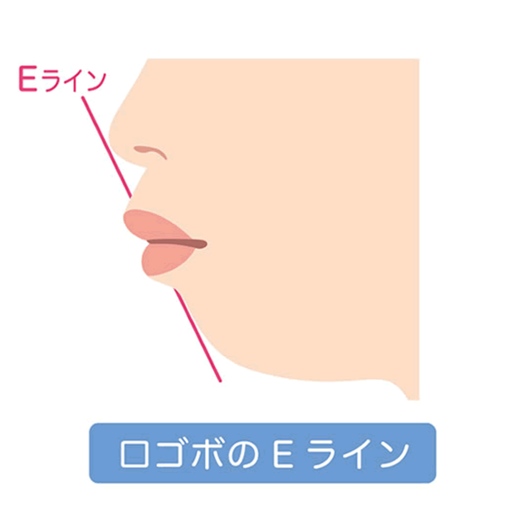 口ゴボの状態の図解