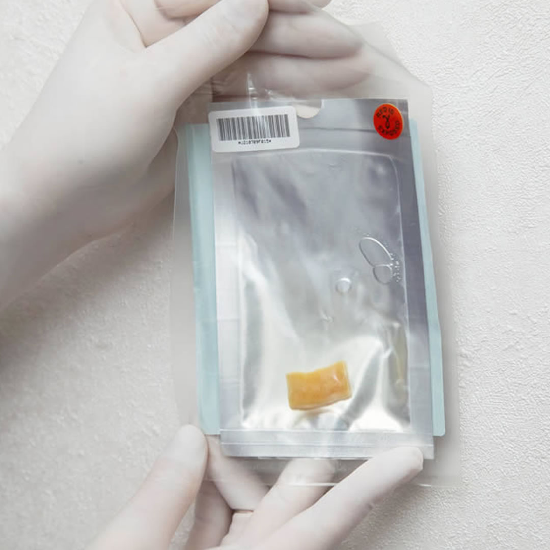 軟骨のイメージ