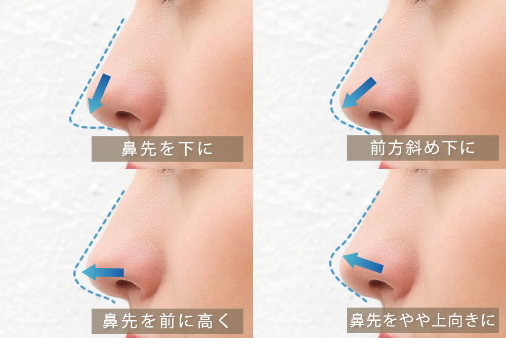 鼻先の向きを変える図解