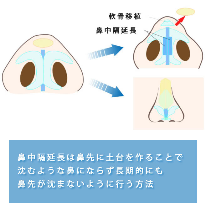 鼻中隔延長の役割の説明の図解