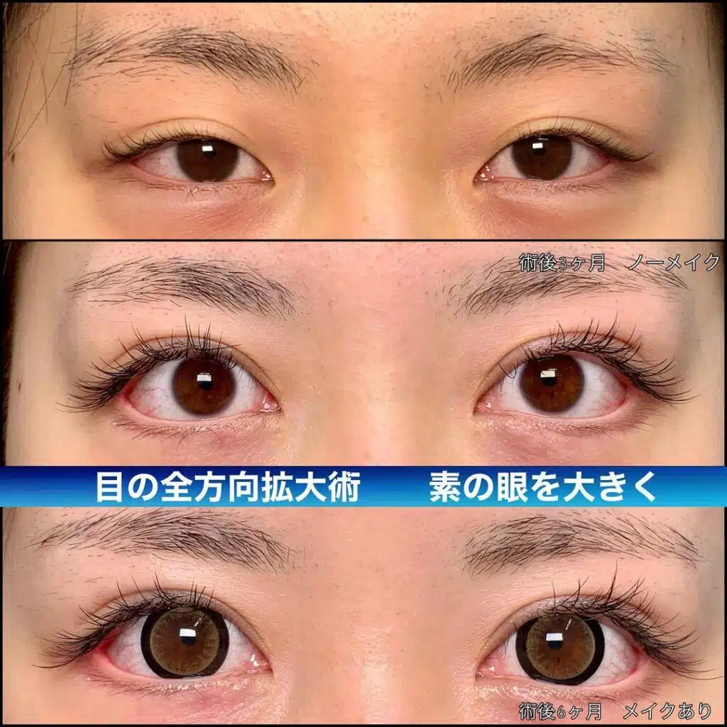 全方向拡大