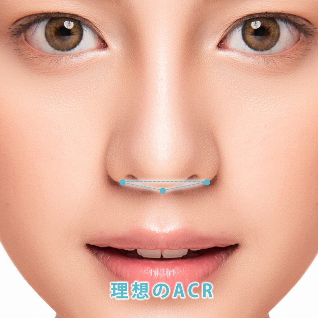 理想のACRの図解