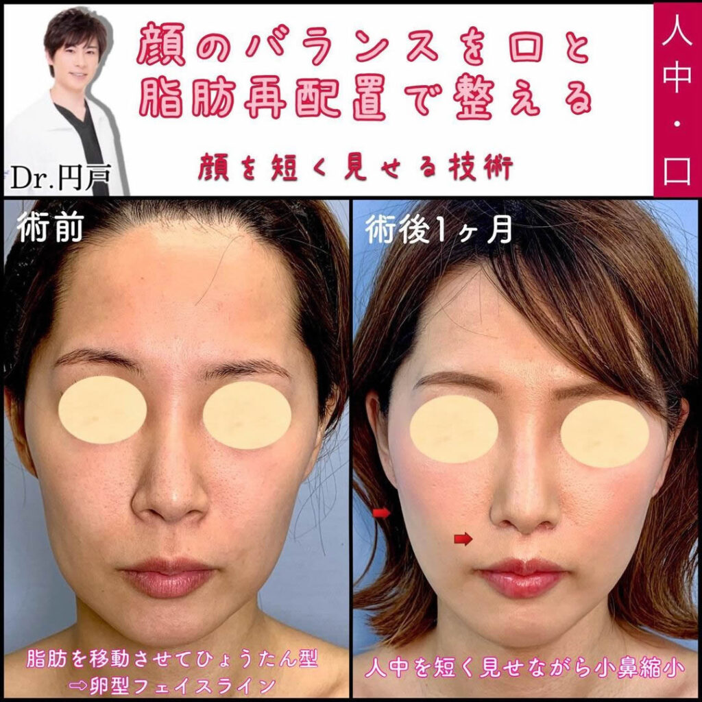円戸統括院長が行った症例写真