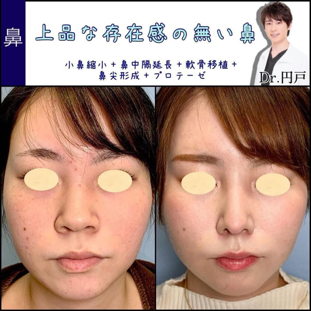 円戸統括院長が行った症例写真