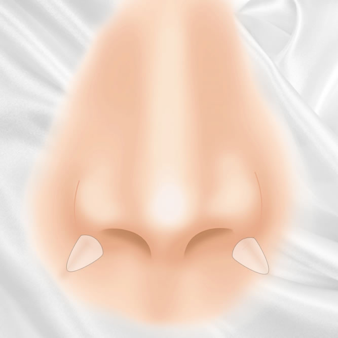 貴族手術のアイコン