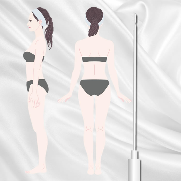 脂肪吸引のアイコン