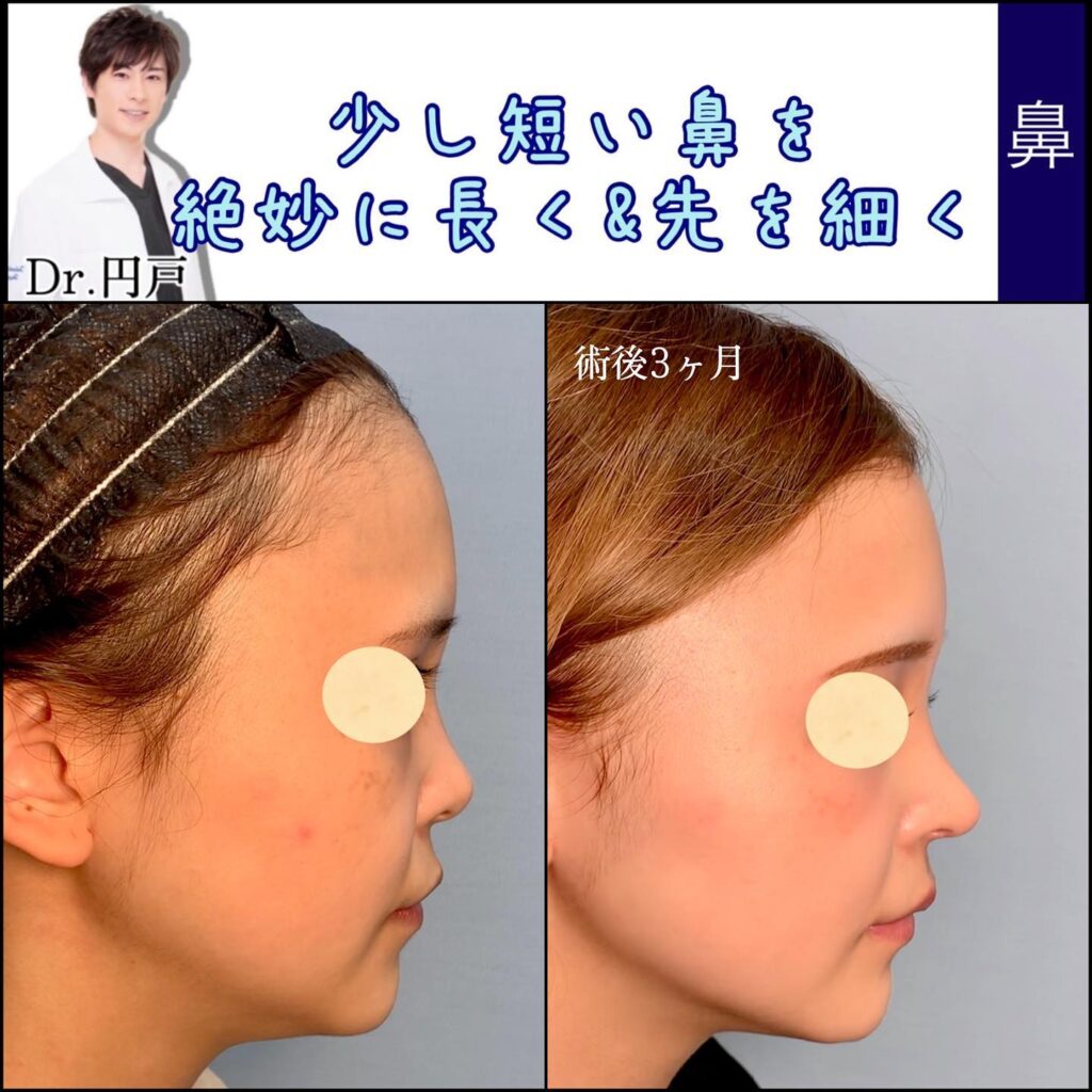 鼻先を短くした症例