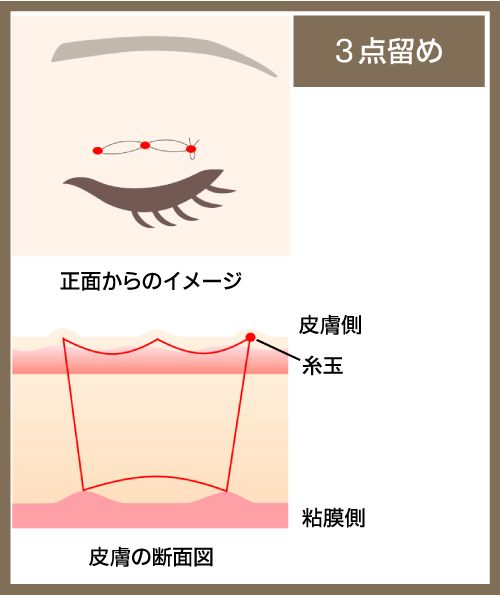 3点留めの図解