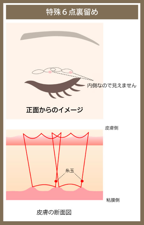 特殊6点裏留めの図解