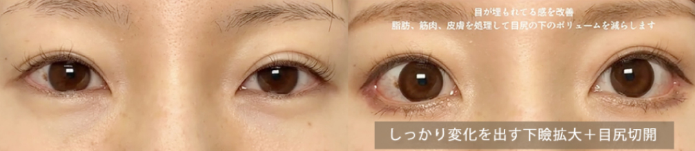 下瞼の形は⼤きく変えず⽬尻の位置を下げるデザイン