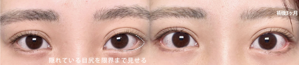 ⽬尻の位置を下げて垂れ⽬にするデザイン