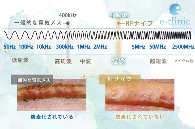 RFナイフの説明の図解