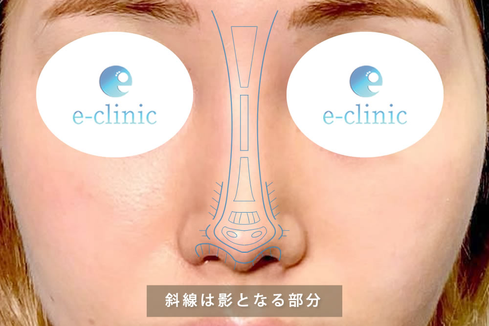 光を計算したデザイン画像
