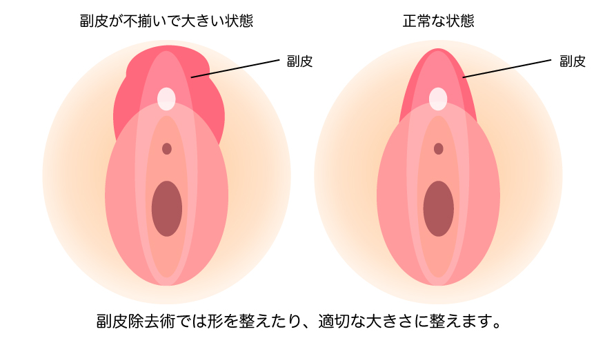 副皮を説明する画像