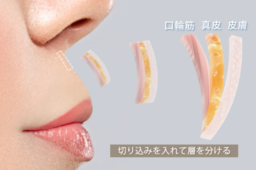唇の皮膚の断面図