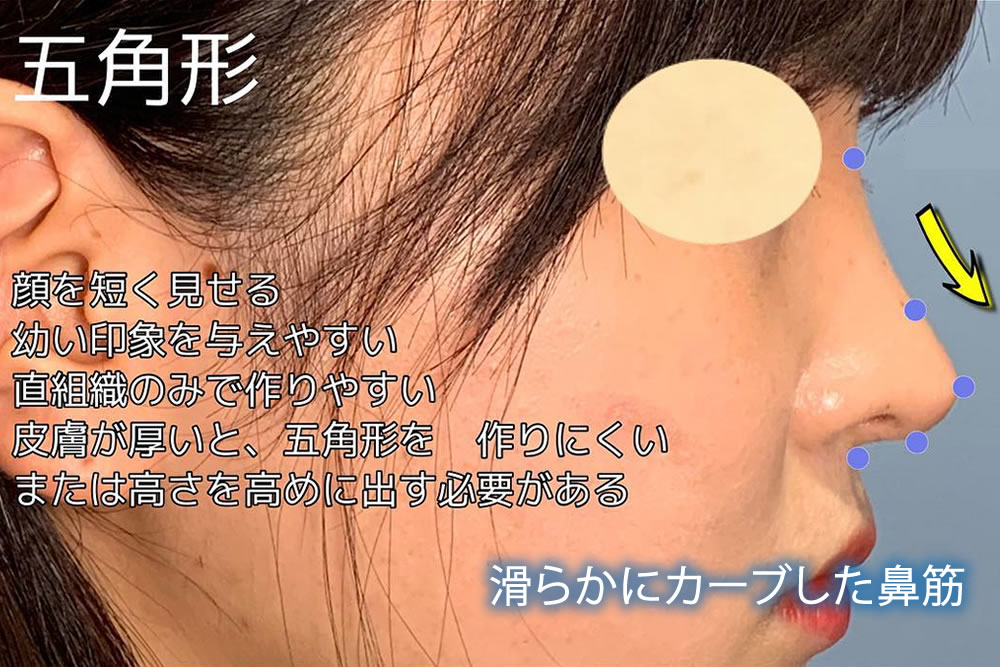 五角形の鼻筋のイメージ
