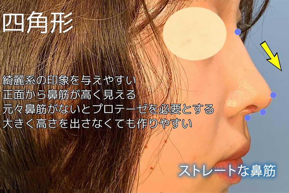 四角形の鼻筋のイメージ