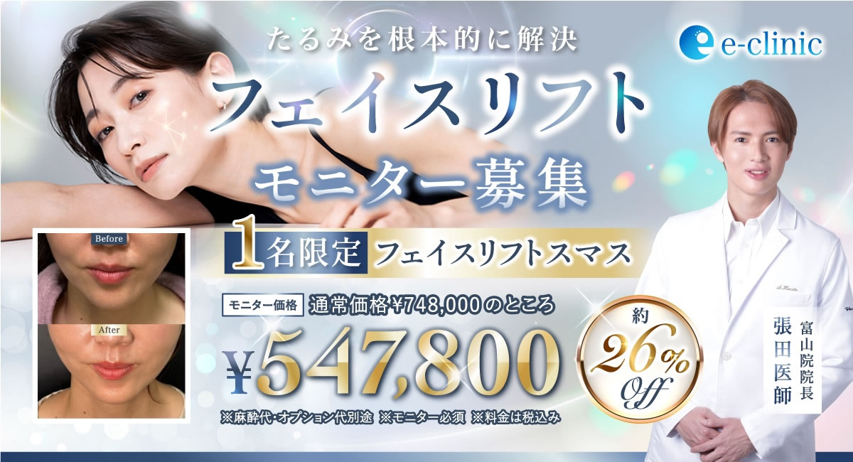 フェイスリフトのキャンペーンバナー
