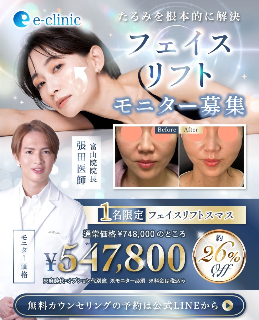 フェイスリフトのキャンペーンバナー
