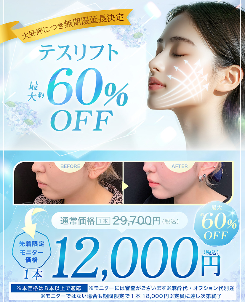 テスリフトのバナー