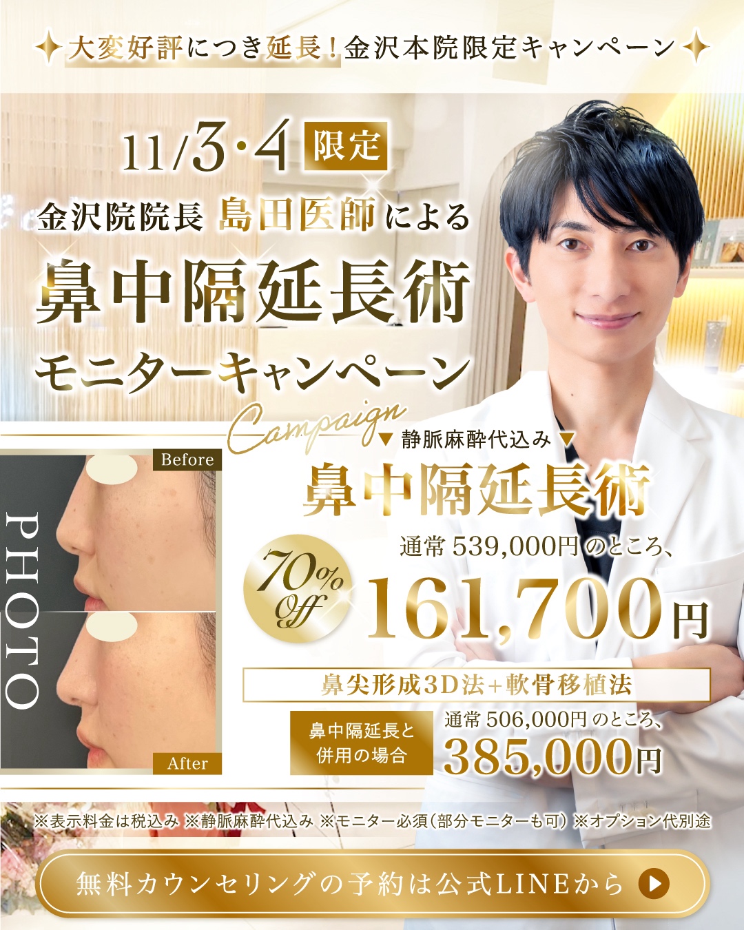 島田院長の鼻中隔延長バナー