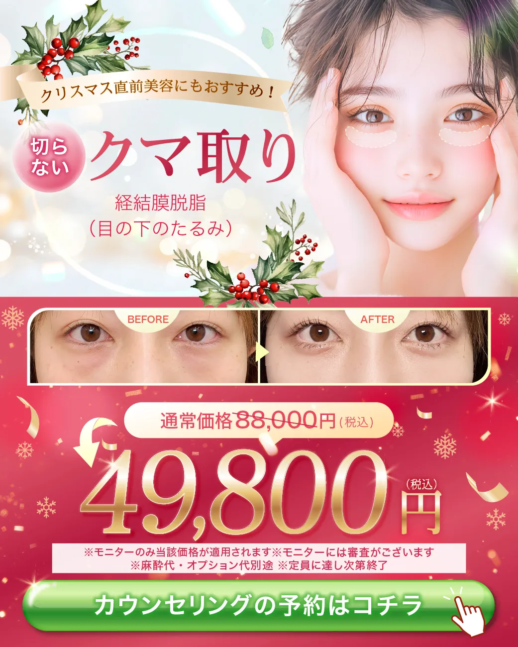 クマ取りのバナー