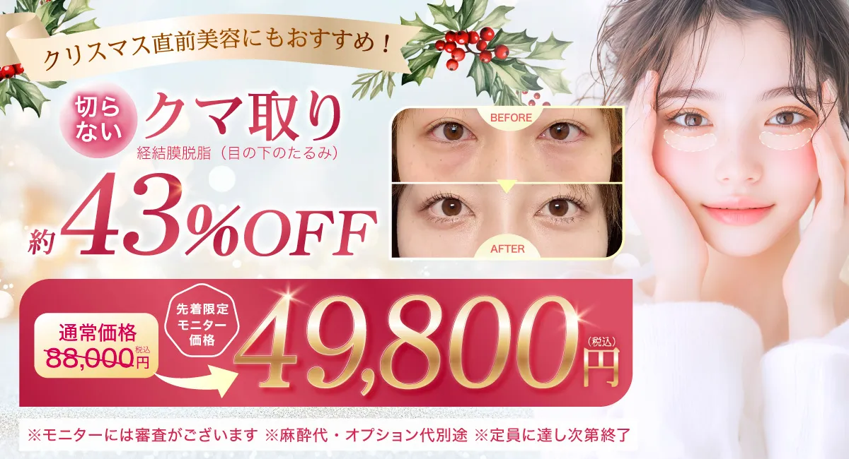 クマ取りのバナー