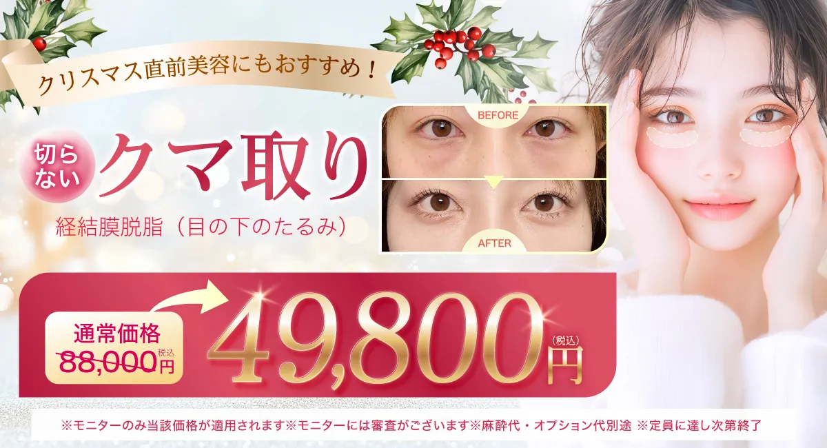 クマ取りのバナー