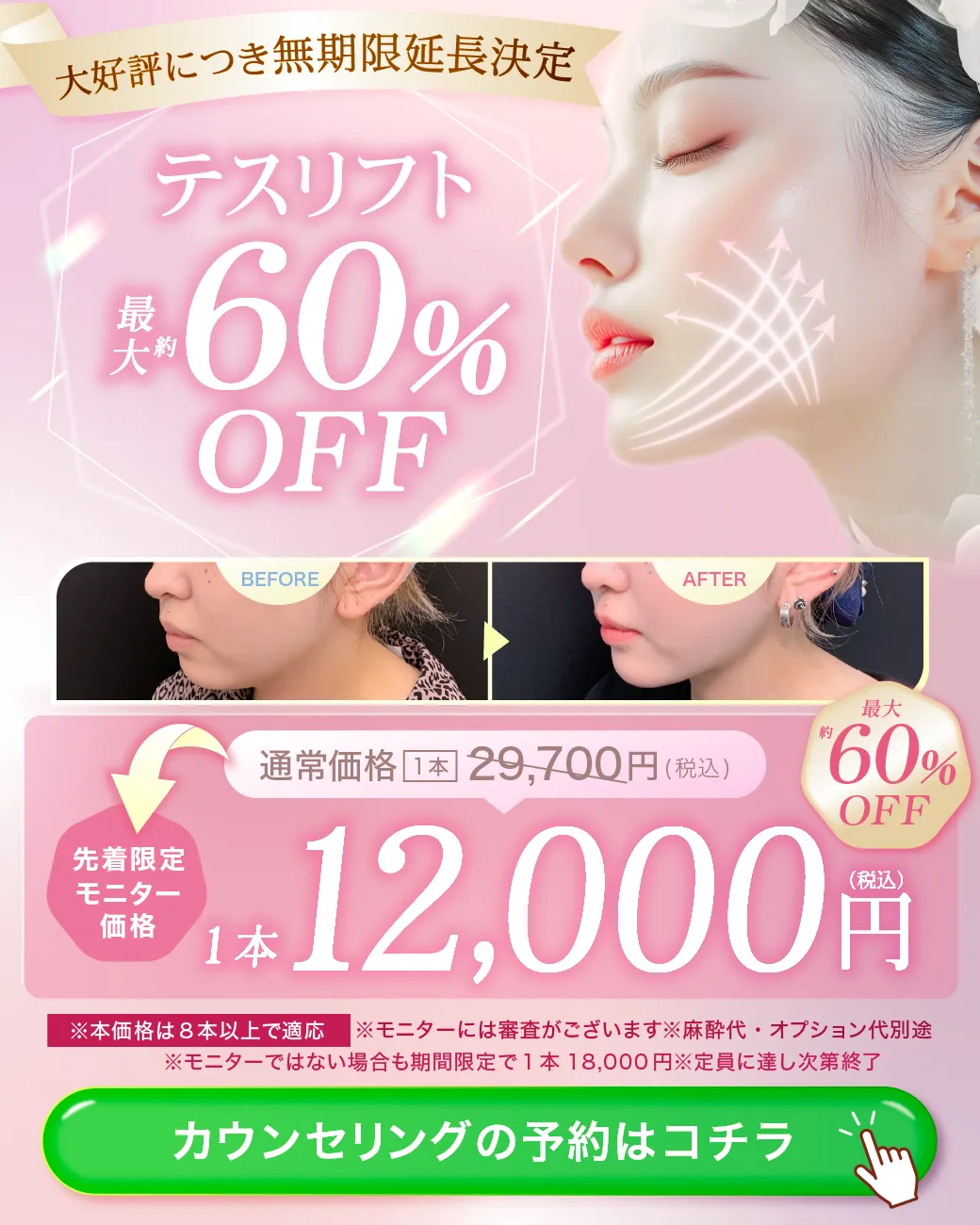 閑散期テスリフトCP